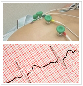 心電図検査