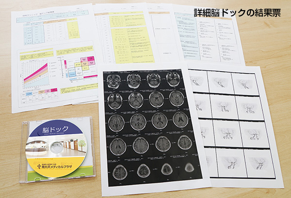 脳ドックの検査結果表