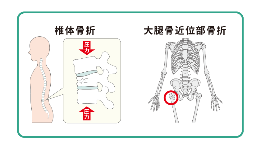 交通事故